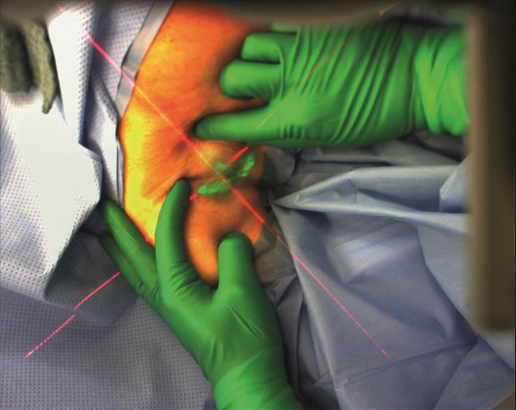 Fraunhofer IGD: Augmented Reality im OP