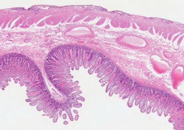 Darmsanierung – der Gesundheits-Booster