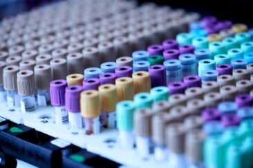 FDA erteilt Screeningtest von DCG zur Früherkennung von Prostatakrebs „Breakthrough Device Designation“