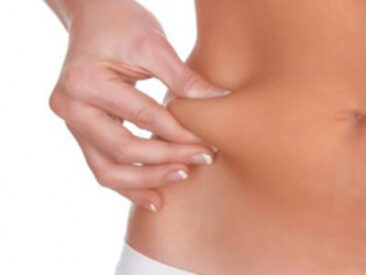 Fett-weg-Spritze (Lipolyse). Kann es wirklich so einfach sein?