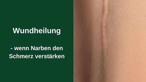 Wundheilung – wenn Narben den Schmerz verstärken