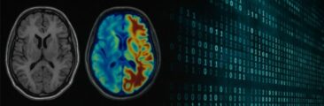 Neue Ära in der Diagnostik: mAInthink UDA Framework überwindet Domain Shift in der Bildgebung