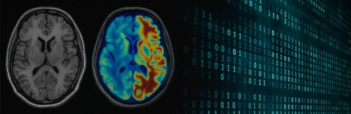 Neue Ära in der Diagnostik: mAInthink UDA Framework überwindet Domain Shift in der Bildgebung