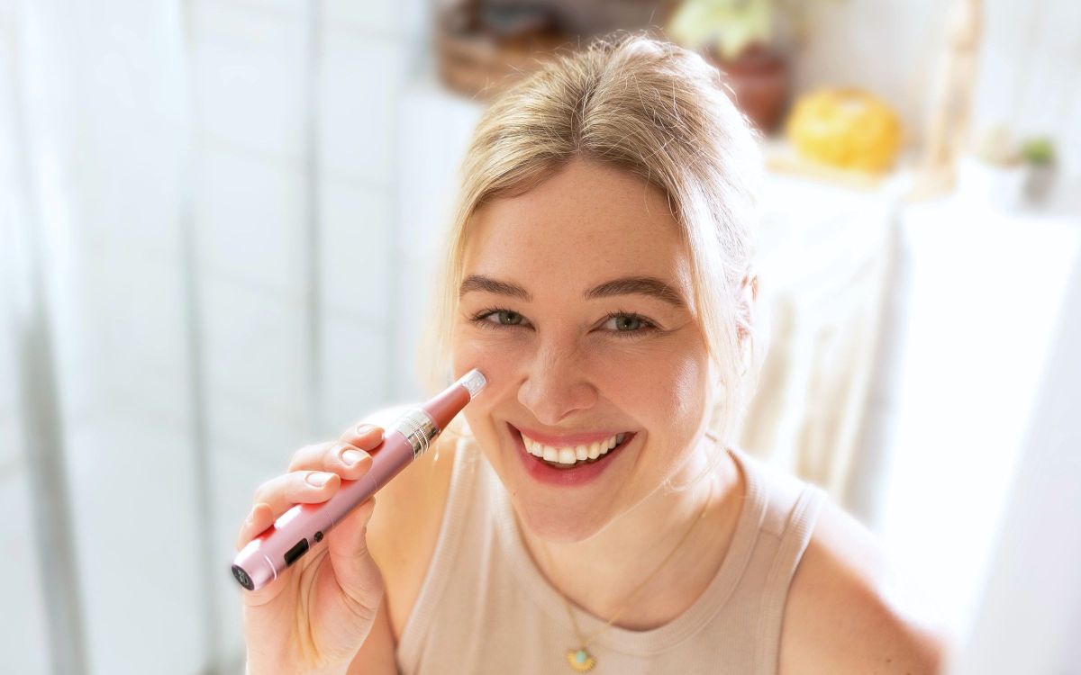 Microneedling Vorher-Nachher: SkinGlowUp zeigt, wie sich Falten gezielt zuhause behandeln lassen