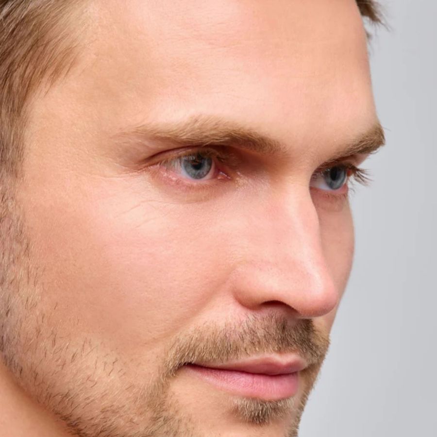 Warum die Unterlidstraffung als der effektivste Frische-Kick in der Gesichtschirurgie gilt