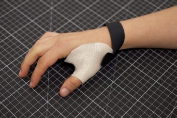 Ergotherapie stärkt Beweglichkeit von Hand und Fingern