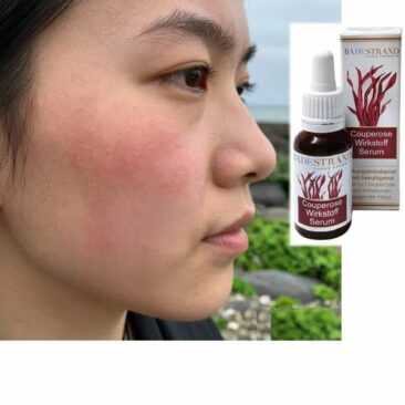 Rötungsmindernd & hautverbessernd – Couperose-Wirkstoff-Serum von Badestrand Kosmetik