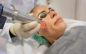 Fraktionierter CO?-Laser in Düsseldorf: Schonende Hautverjüngung & Narbenbehandlung durch erfahrene Fachärzte