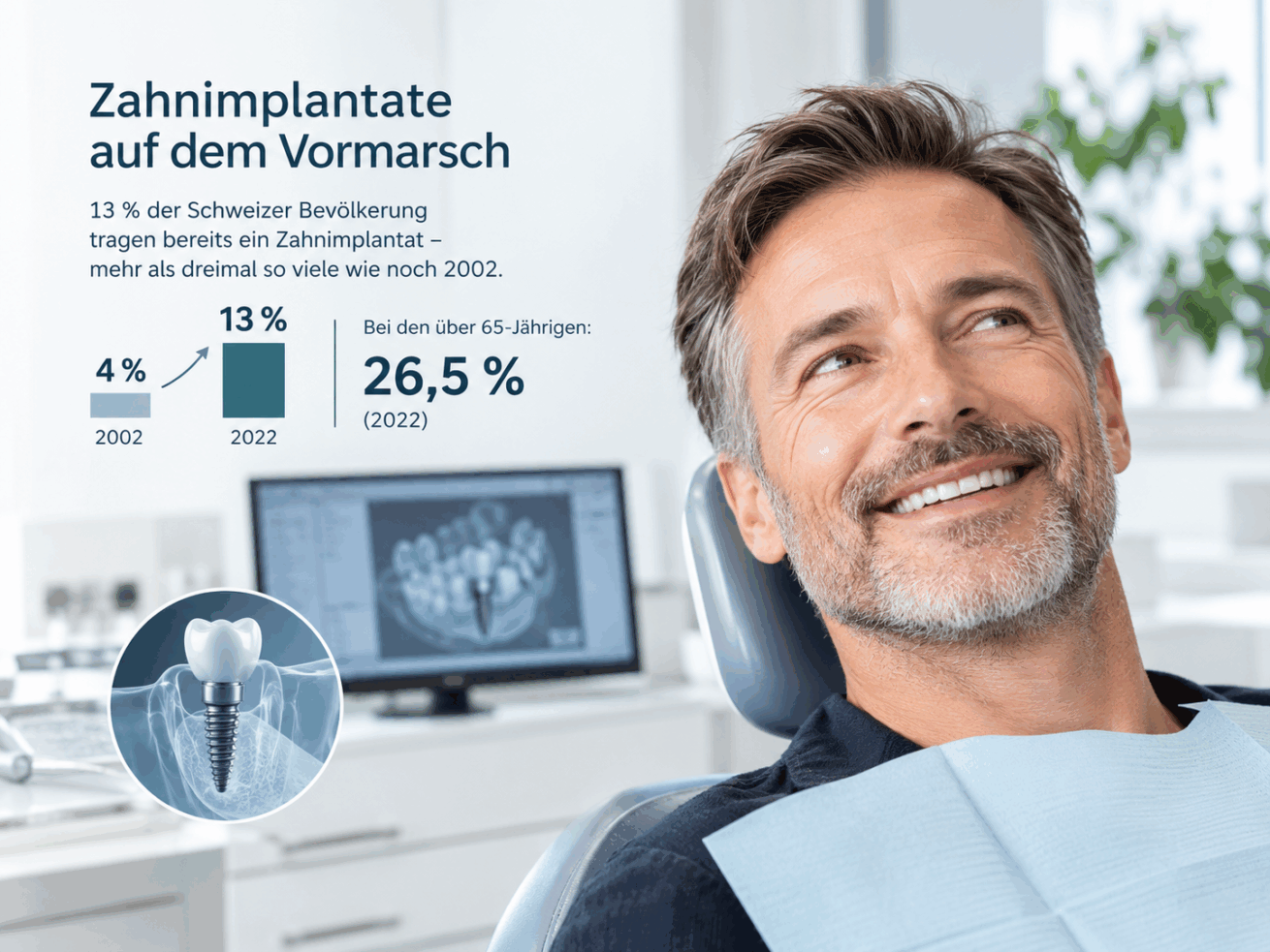 Zahnimplantate auf dem Vormarsch: 13 Prozent der Schweizer Bevölkerung tragen bereits eines